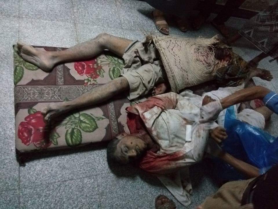 Saudi Air Force Struck Yemen's City of Al Hudaydah: 25 Killed, 76 Wounded (Photos 18+)