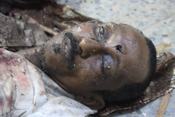 Saudi Air Force Struck Yemen's City of Al Hudaydah: 25 Killed, 76 Wounded (Photos 18+)