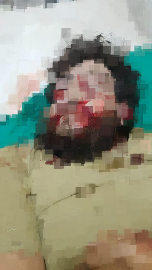 Commander Of Sham Legion Assassinated In Syria's Aleppo Province (Map Update)