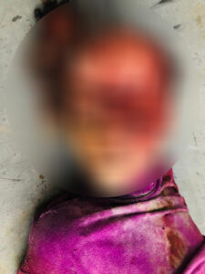 Massacre In Northeastern Syria: Father, Three Children Killed In Turkish Shelling (Photos)