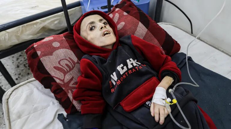 With U.S. Help, Israel Is Starving Children To Death In Gaza